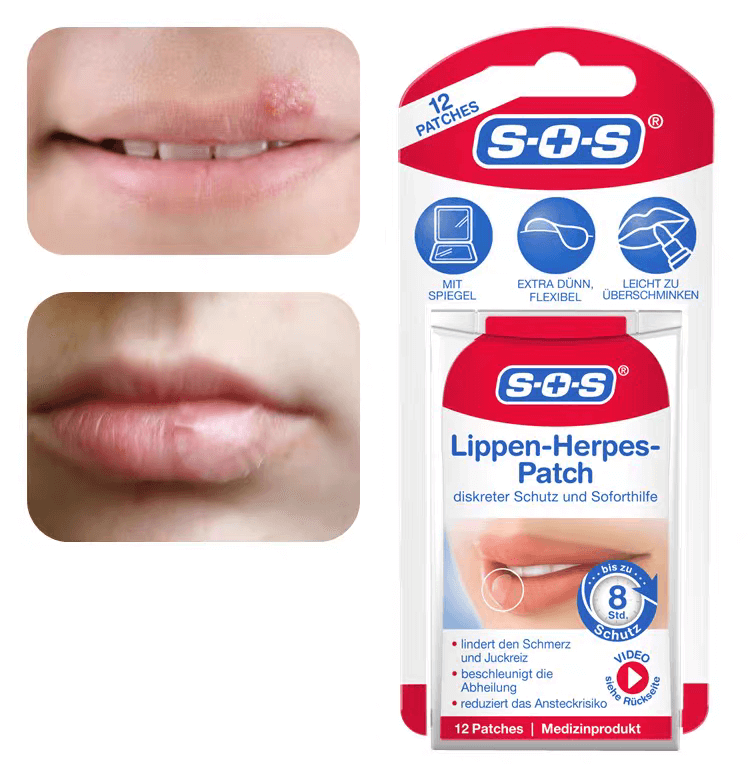 德國sos唇皰疹貼片1704247531701660.png 德國sos唇皰疹貼片