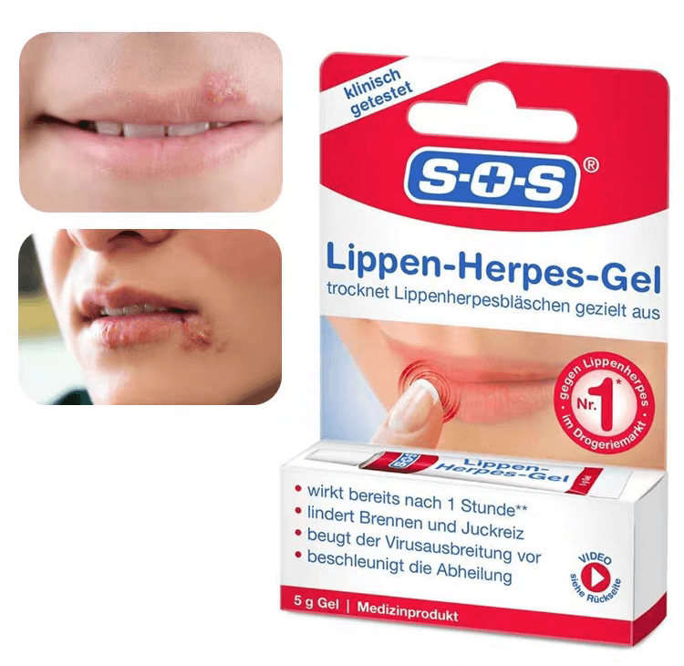 SOS唇部舒緩修復凝膠1704259927725332.png SOS唇部舒緩修復凝膠