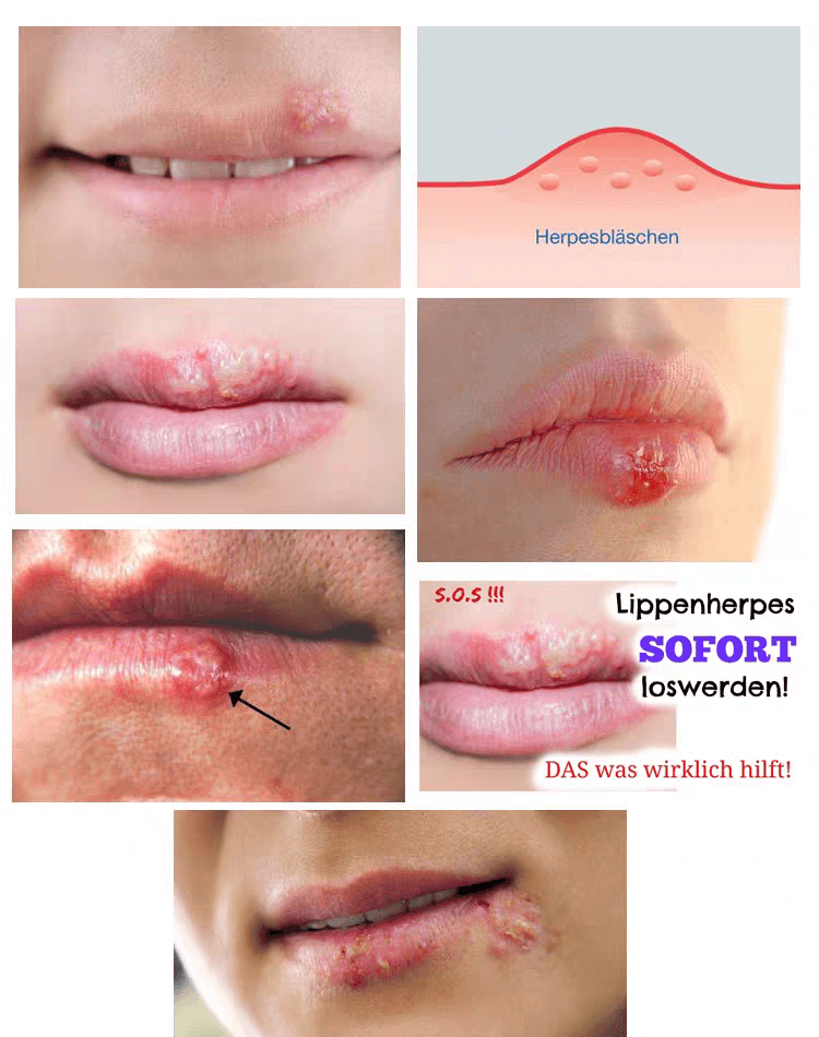 SOS唇部舒緩修復凝膠1704259928983583.png SOS唇部舒緩修復凝膠