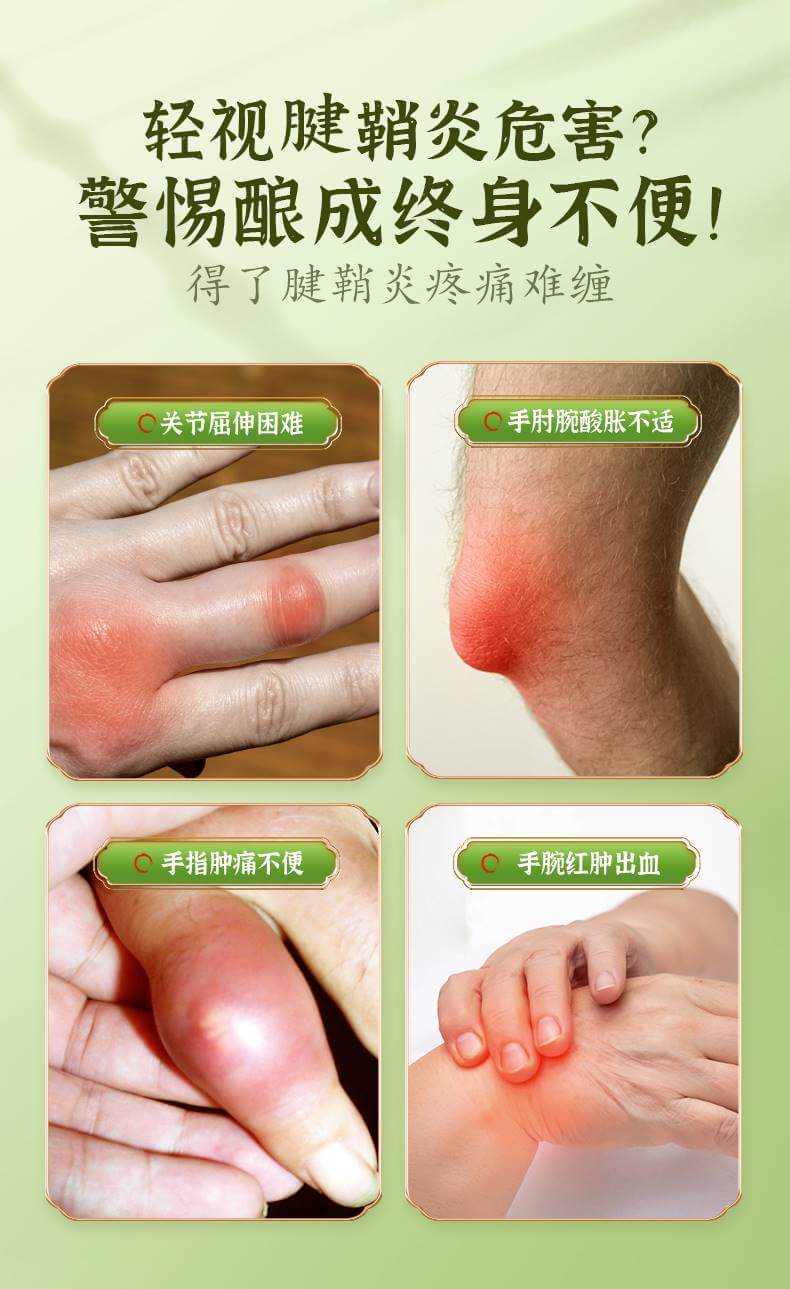 寶元堂腱鞘炎型冷敷凝膠