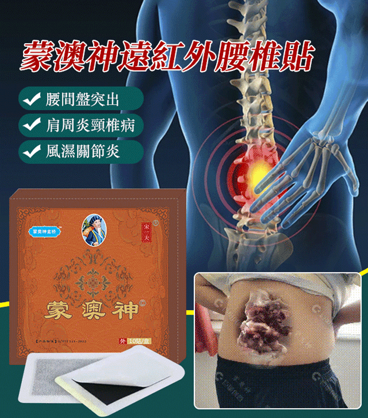 蒙澳神遠紅外腰椎貼