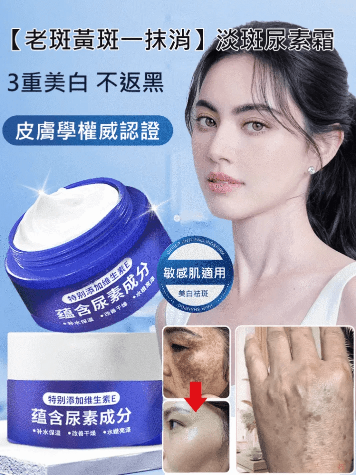 【老斑黃斑一抹消】淡斑尿素霜